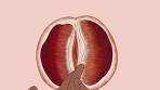 کیا شرم گاہ کو مسلنے (مشت زنی) سے... - Gynae Doctor's online