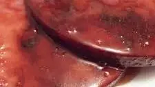 Easy Tasty Ham Steaks with Maple Glaze for Two