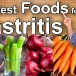 What to eat for breakfast with ulcer? Image depicting the best foods for gastritis, featuring fresh vegetables such as celery, red onions, and carrots, along with a person pointing to the text highlighting dietary recommendations for managing gastritis.